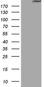STAB2 Antibody in Western Blot (WB)