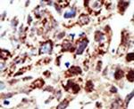 STAM Antibody in Immunohistochemistry (IHC)