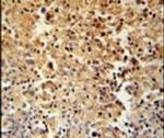 STAMBPL1 Antibody in Immunohistochemistry (IHC)