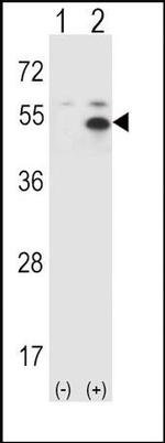 STAM Antibody in Western Blot (WB)