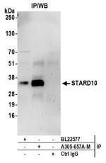 STARD10 Polyclonal Antibody