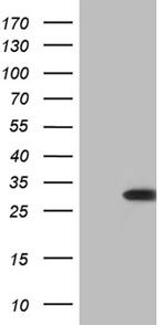 STARD4 Antibody in Western Blot (WB)