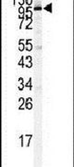 STAT2 Antibody in Western Blot (WB)