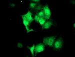 STAT4 Antibody in Immunocytochemistry (ICC/IF)