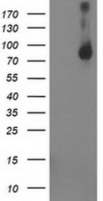 STAT4 Antibody in Western Blot (WB)