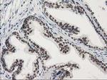 STAT5A Antibody in Immunohistochemistry (Paraffin) (IHC (P))