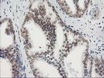 STAT5A Antibody in Immunohistochemistry (Paraffin) (IHC (P))
