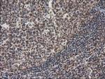 STAT5A Antibody in Immunohistochemistry (Paraffin) (IHC (P))
