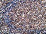 STAT5A Antibody in Immunohistochemistry (Paraffin) (IHC (P))