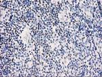 STAT5A Antibody in Immunohistochemistry (Paraffin) (IHC (P))