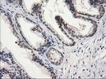 STAT5A Antibody in Immunohistochemistry (Paraffin) (IHC (P))