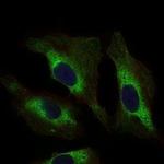 STAT5 alpha Monoclonal Antibody (6D4)