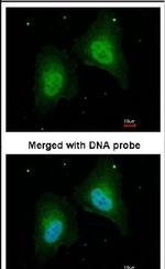 STAT5B Antibody in Immunocytochemistry (ICC/IF)
