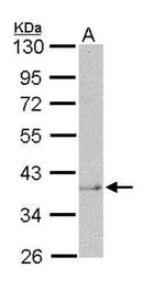 STAT5B Antibody in Western Blot (WB)