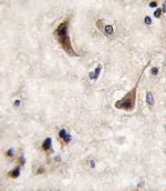 STEP Antibody in Immunohistochemistry (IHC)