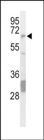 STEP Antibody in Western Blot (WB)