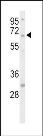 STEP Antibody in Western Blot (WB)