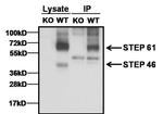 STEP Antibody in Immunoprecipitation (IP)