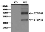 STEP Antibody in Western Blot (WB)