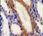 STIM1 Antibody in Immunohistochemistry (IHC)