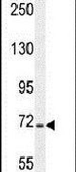 STIM1 Antibody in Western Blot (WB)