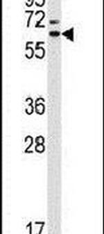 STIP1 Antibody in Western Blot (WB)