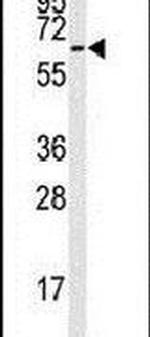 STIP1 Antibody in Western Blot (WB)