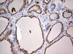 STK11 Antibody in Immunohistochemistry (Paraffin) (IHC (P))