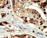 STK16 Antibody in Immunohistochemistry (IHC)