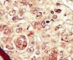 STK16 Antibody in Immunohistochemistry (IHC)