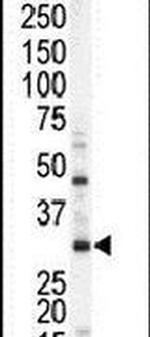 STK16 Antibody in Western Blot (WB)