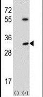 STK16 Antibody in Western Blot (WB)