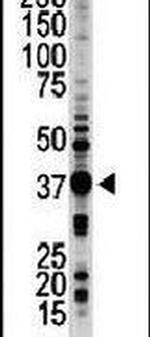 STK16 Antibody in Western Blot (WB)