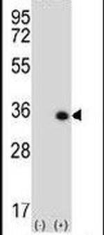 STK16 Antibody in Western Blot (WB)