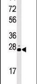 STK19 Antibody in Western Blot (WB)