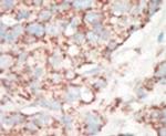 STK25 Antibody in Immunohistochemistry (IHC)