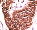 STK29 Antibody in Immunohistochemistry (IHC)