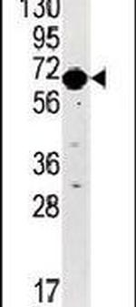 STK29 Antibody in Western Blot (WB)
