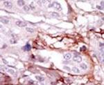 STK31 Antibody in Immunohistochemistry (IHC)