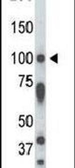 STK31 Antibody in Western Blot (WB)