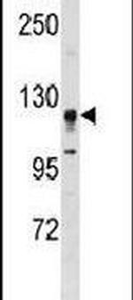 STK31 Antibody in Western Blot (WB)