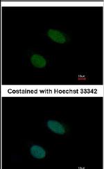 STK32A Antibody in Immunocytochemistry (ICC/IF)