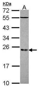 STK32A Antibody in Western Blot (WB)