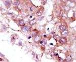 STK33 Antibody in Immunohistochemistry (IHC)