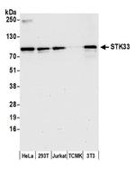 STK33 Polyclonal Antibody