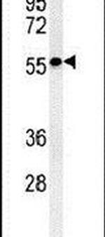 STK33 Antibody in Western Blot (WB)