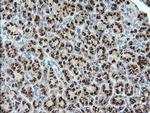 STK38L Antibody in Immunohistochemistry (Paraffin) (IHC (P))