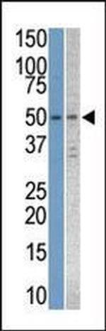 STK38L Antibody in Western Blot (WB)