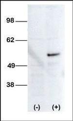 STK38L Antibody in Western Blot (WB)