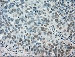 STK39 Antibody in Immunohistochemistry (Paraffin) (IHC (P))